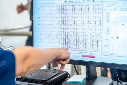 Preview: Data on the computer while man performing a stress test