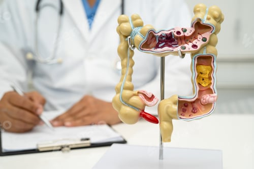 Preview: Intestine, appendix and digestive system, doctor holding anatomy