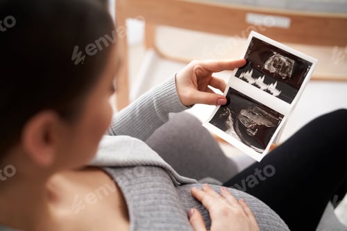 Preview: High angle view on caucasian woman in advanced pregnancy browsing ultrasound scan