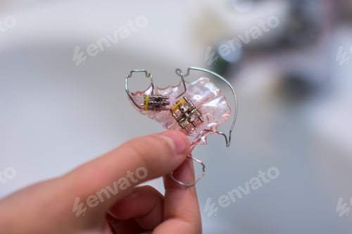 Preview: Orthodontic trainer, the chance of a beautiful smile.