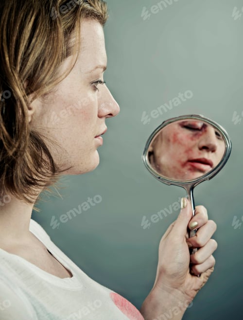 Preview: Woman examining her bruised face