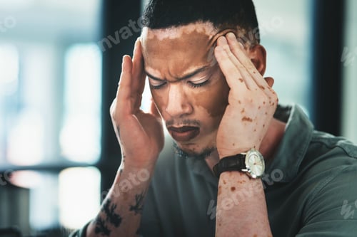 Preview: Shot of a young businessman struggling with a headache in an office at work
