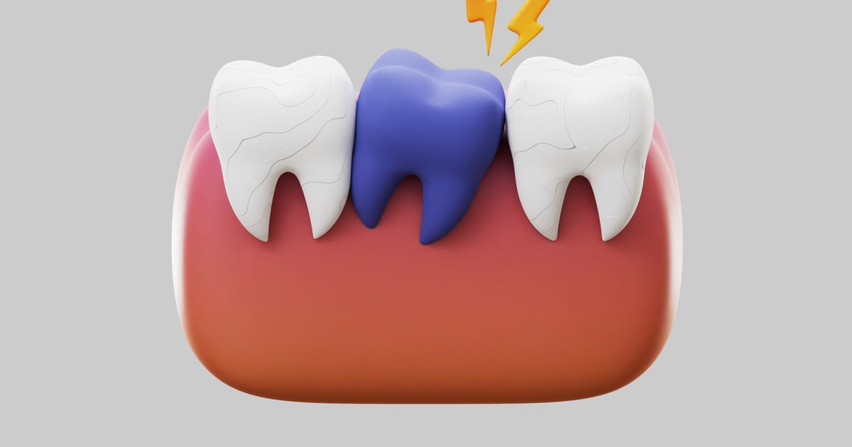 Toothache with blue tooth 3D, Incl. anatomy & dental - Envato