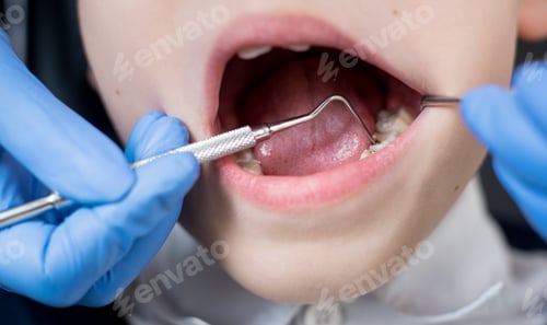 Preview: Female dentist examines the teeth of the patient child