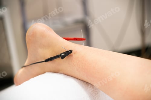 Preview: Electro-acupuncture dry with needle connecting machine