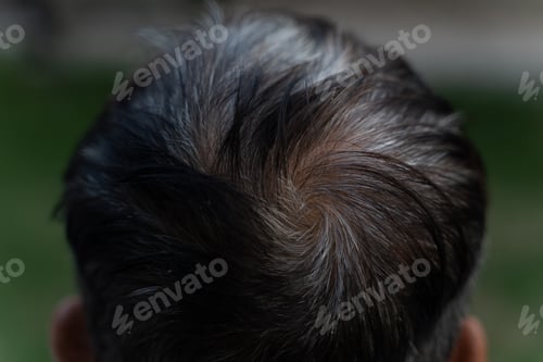 Preview: Close up picture of gray hair
