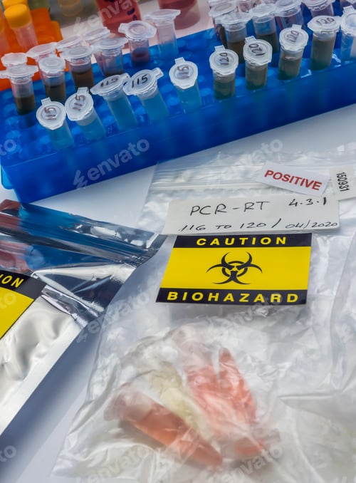 Preview: Vials with samples of SARS-COV-2 Covid-19 in a research laboratory