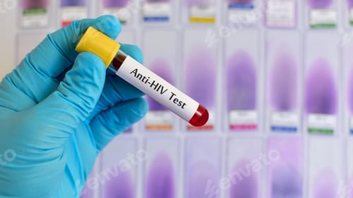 Preview: Anti-HIV virus, medical concept, Human Immunodeficiency Virus Positive test