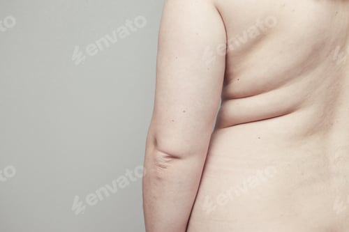 Preview: Overweight, fat body concept. The effect of insulin on the human body