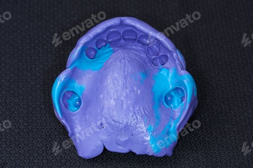 Preview: oral rehabilitation process, partial removable prosthesis