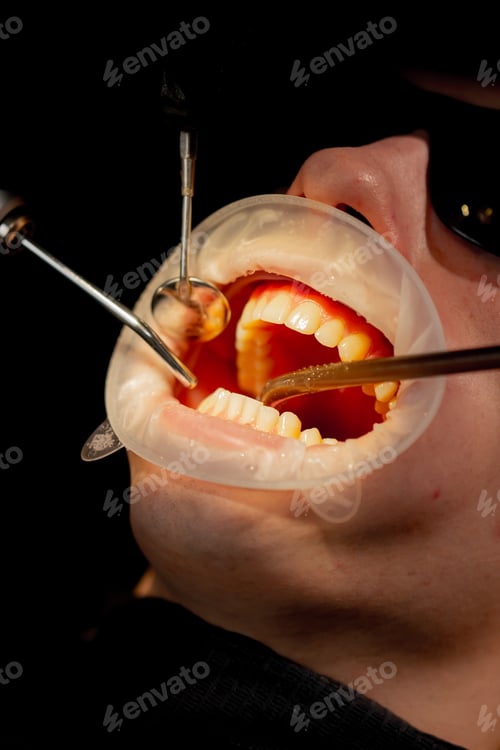 Preview: close up dental office girl dentist doing cleaning to young guy before the whitening procedure