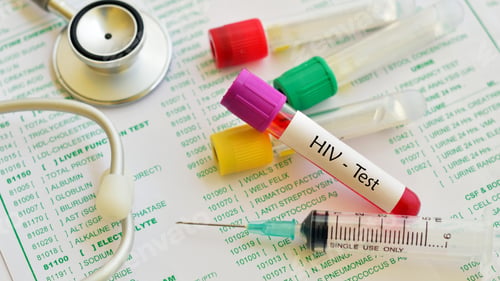 Preview: HIV virus, medical concept, Human Immunodeficiency Virus Positive test
