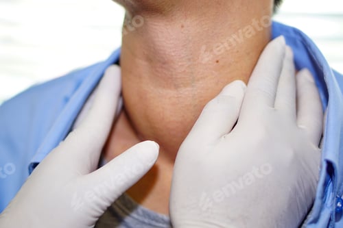 Preview: Asian lady woman patient have abnormal enlargement of thyroid gland Hyperthyroidism at throat.