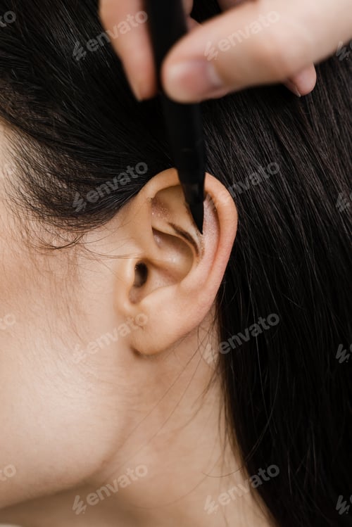 Preview: Ear marking preparation for otoplasty by surgeon