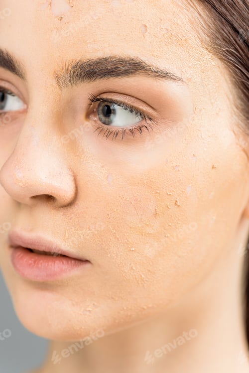 Preview: close up of young woman with problem skin
