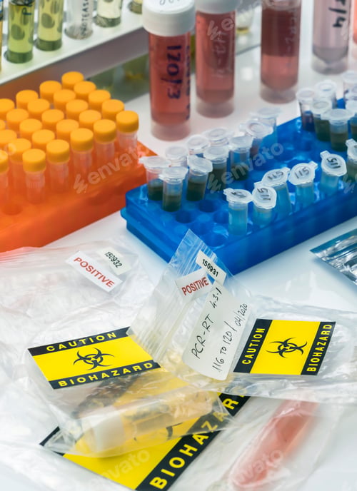 Preview: Vials with samples of SARS-COV-2 Covid-19 in a research laboratory