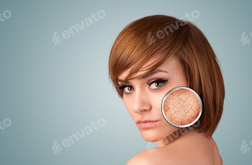 Preview: Healthy Beautiful Young Girl With Magnifying Glass Of Skin Damage
