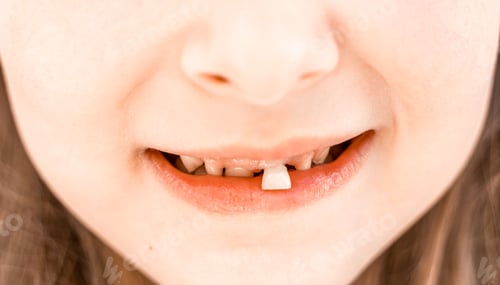 Preview: Charming smiling little girl kid with opened mouth shows staggering loose falling out first baby
