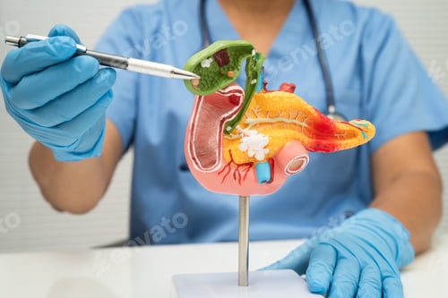 Preview: Pancreatitis, pancreatic cancer, Asian doctor with pancreas, gallbladder
