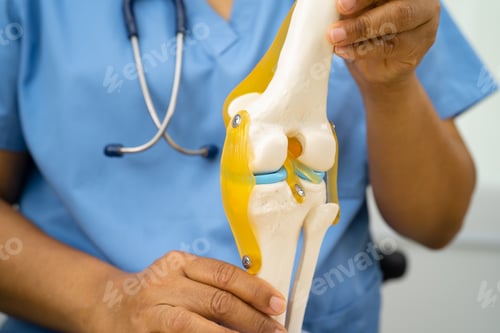 Preview: Osteoarthritis of the knee, Doctor holding human knee joint orthopedic anatomy