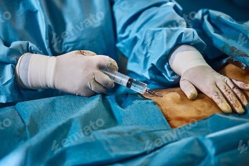 Preview: Surgical operation liposuction of the abdomen. Close-up of the patient on the operating table