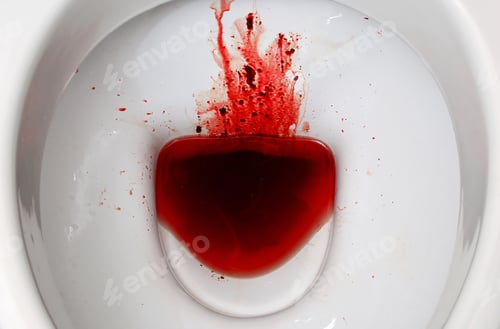 Preview: A white ceramic toilet bowl is stained with blood. The consequences of pronounced ms