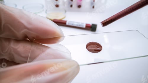 Preview: Coronavirus infected blood sample. Scientist doing analysis to Covid-19