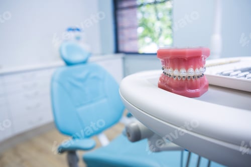 Preview: Dental mold on table by chair