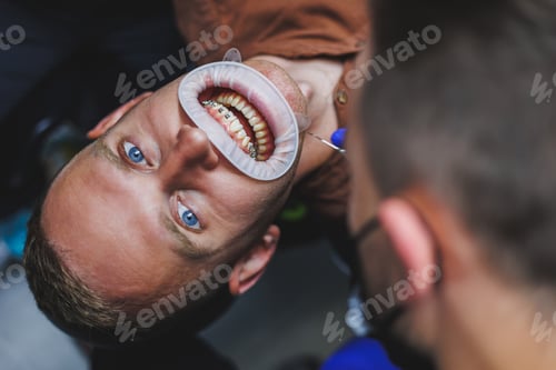 Preview: Dental treatment of teeth. A young man at a dentist's appointment. The doctor