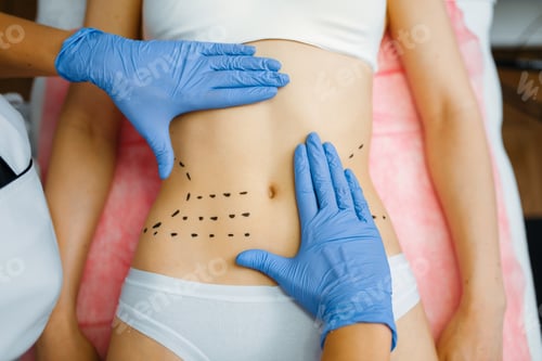 Preparing for cosmetic surgery for abdomen
