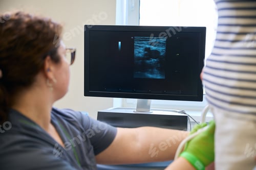 Preview: Doctor conducts an ultrasound diagnosis of vessels of patients legs