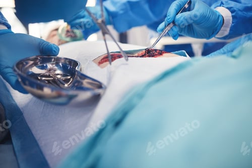 Preview: Surgery, team hands and patient operation, hospital emergency or group of doctors help, support or