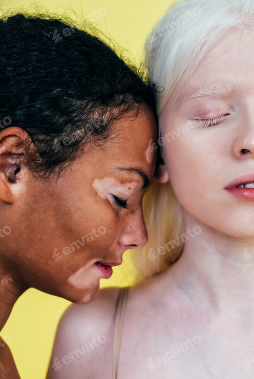 Preview: Couple of multiethnic women
