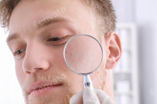 Preview: Dermatologist examining patient with magnifying glass in clinic, closeup view