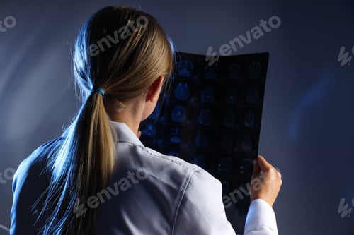 Preview: A young female doctor is looking at an MRI image of a human head