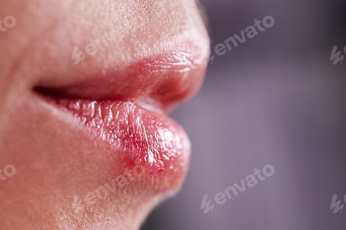Preview: Macro photography of female lips suffering from herpes