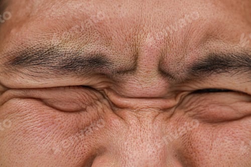 Preview: closeup ugly bad face male oily with large skin pores and pimple macro high detail.