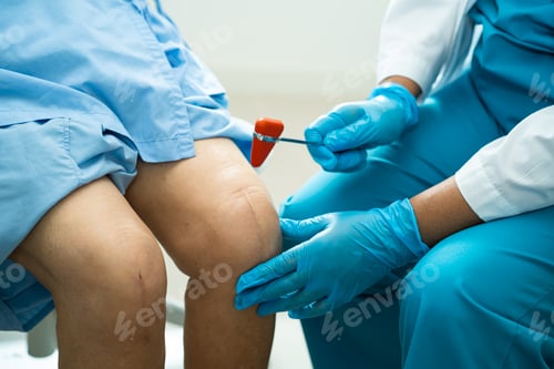 Preview: Asian doctor use hammer knock senior woman patient to check knee reflex, nerve and muscle