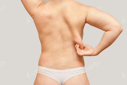 Preview: Caucasian adult female grasping back skin in beige underwear highlighting body