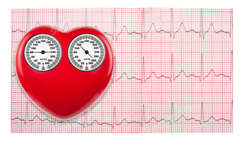 Preview: Arterial blood pressure checking concept