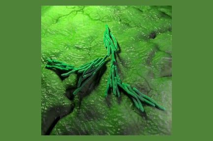 Visualização: Bactéria Mycobacterium Tuberculosis em um biofilme