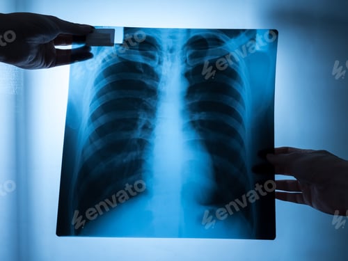 Preview: Specialist doctor examining x-ray film of patient.