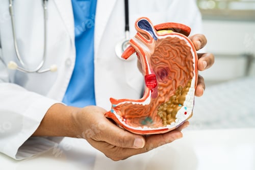Preview: Stomach disease, doctor with anatomy model for study diagnosis and treatment in hospital.