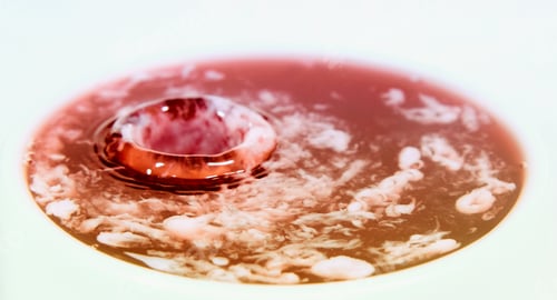 Preview: Abstraction with drops and liquids