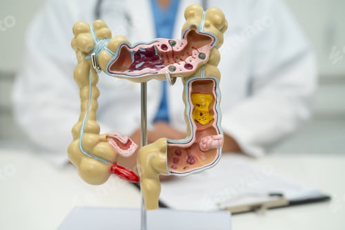 Preview: Intestine, appendix and digestive system, doctor holding anatomy model