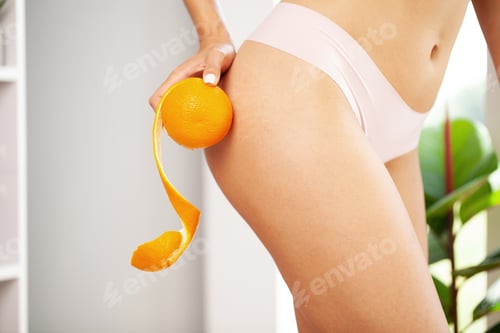 Preview: Cellulite problem concept, young woman holding orange near her leg