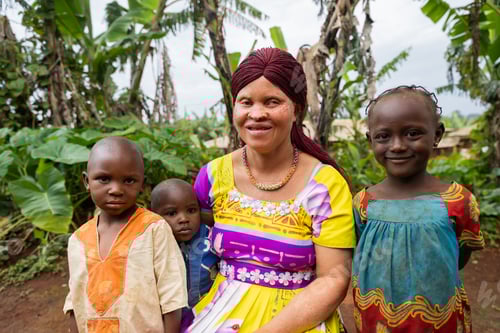 Preview: Young albino mother sitting in her yard with her three children. Motherhood concept