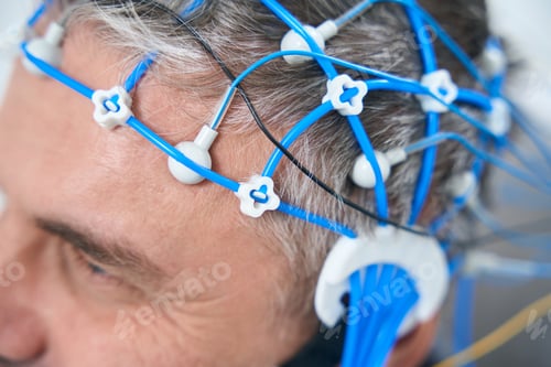 Preview: Middle-aged man on the diagnosis of EEG - electroencephalography