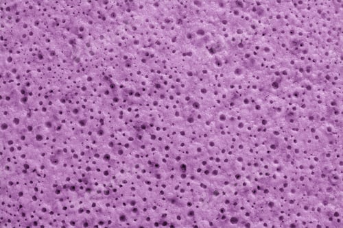 Preview: Abstract Spotty And Porous Organic Texture Closeup For A Background Or For Wallpaper Of Sweet Lilac