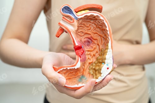 Preview: Stomach disease, Asian woman holding anatomy model for treatment in hospital.